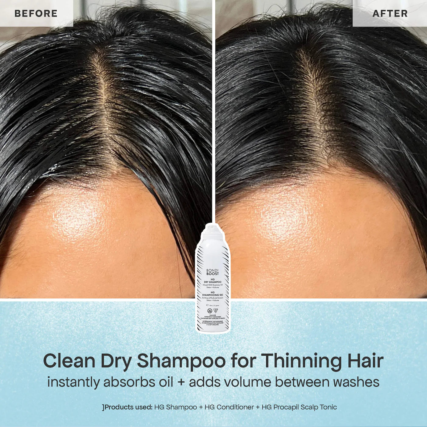 BondiBoost | Bondi Besties Minis Hair Gift Set for Hair Thinning (Minis Set Capilar para Cabello Delgado y con Caída) | Pre-orden