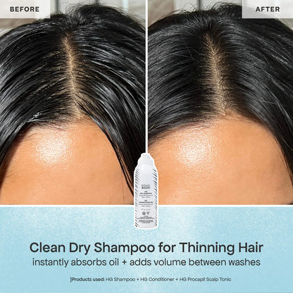 BondiBoost | Bondi Besties Minis Hair Gift Set for Hair Thinning (Minis Set Capilar para Cabello Delgado y con Caída) | Pre-orden