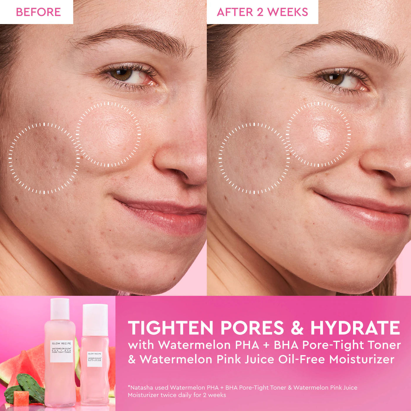 Pre-orden: Glow Recipe | Watermelon Glow PHA + BHA Pore-Tight Toner - Imagen 4