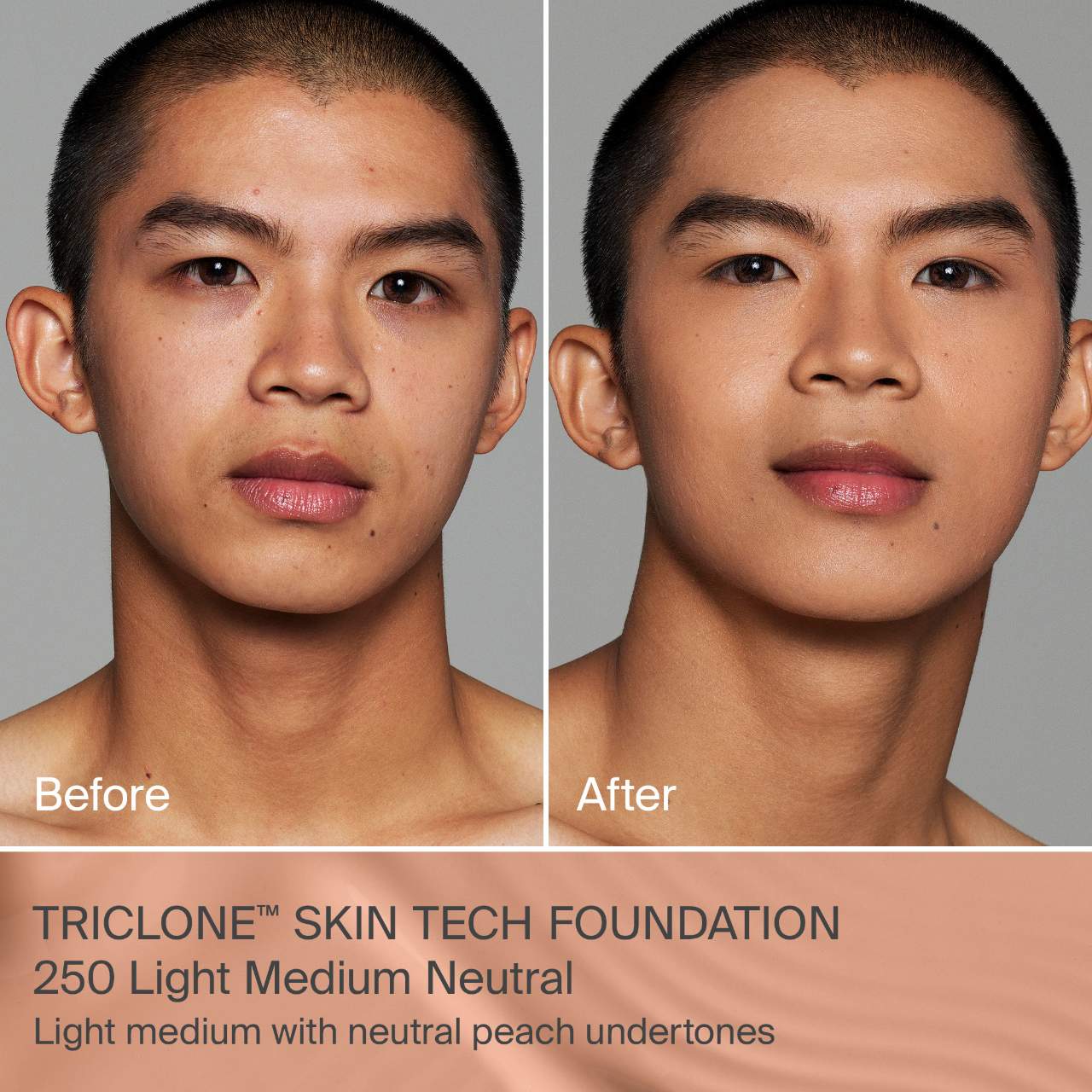 250 Light Medium Neutral