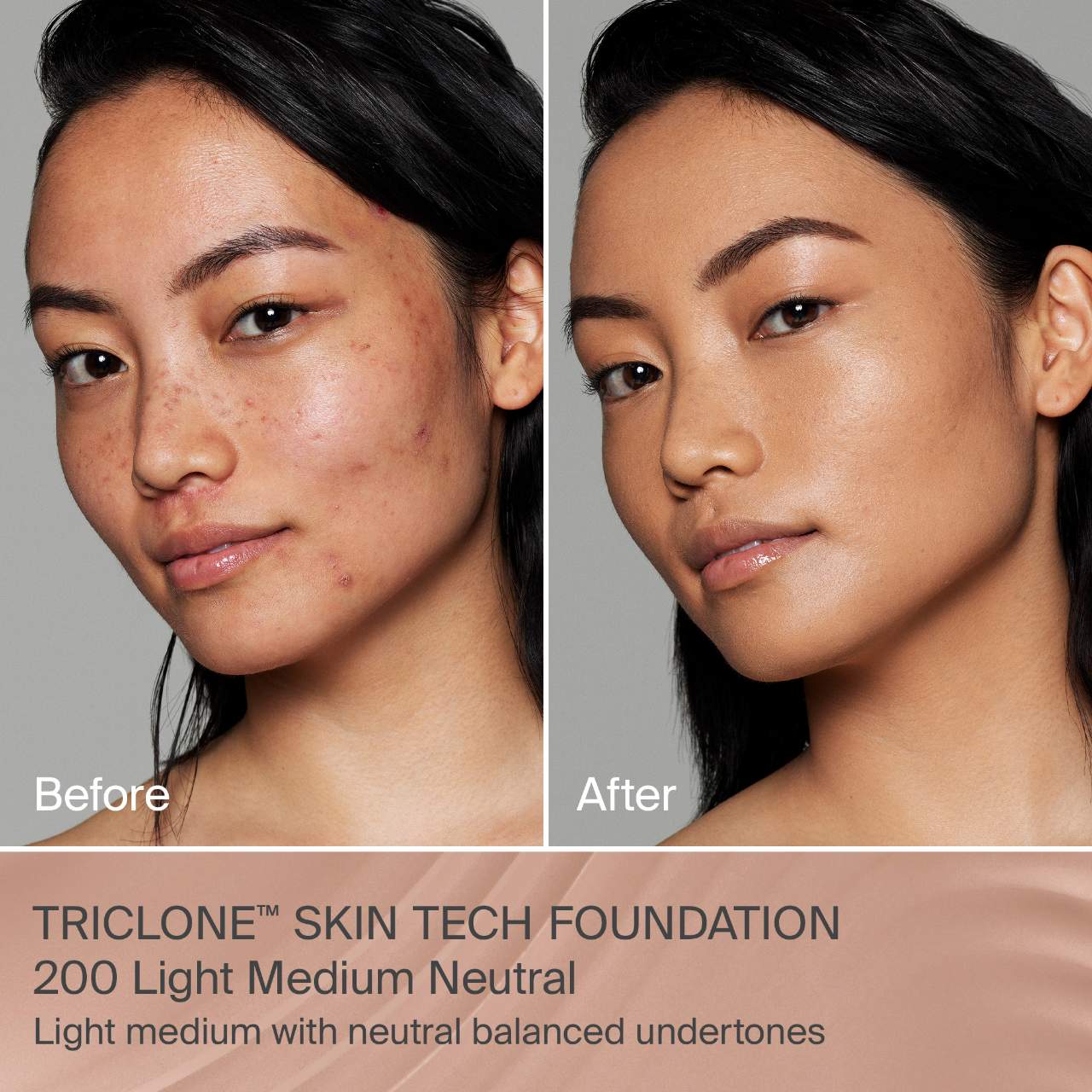 200 Light Medium Neutral