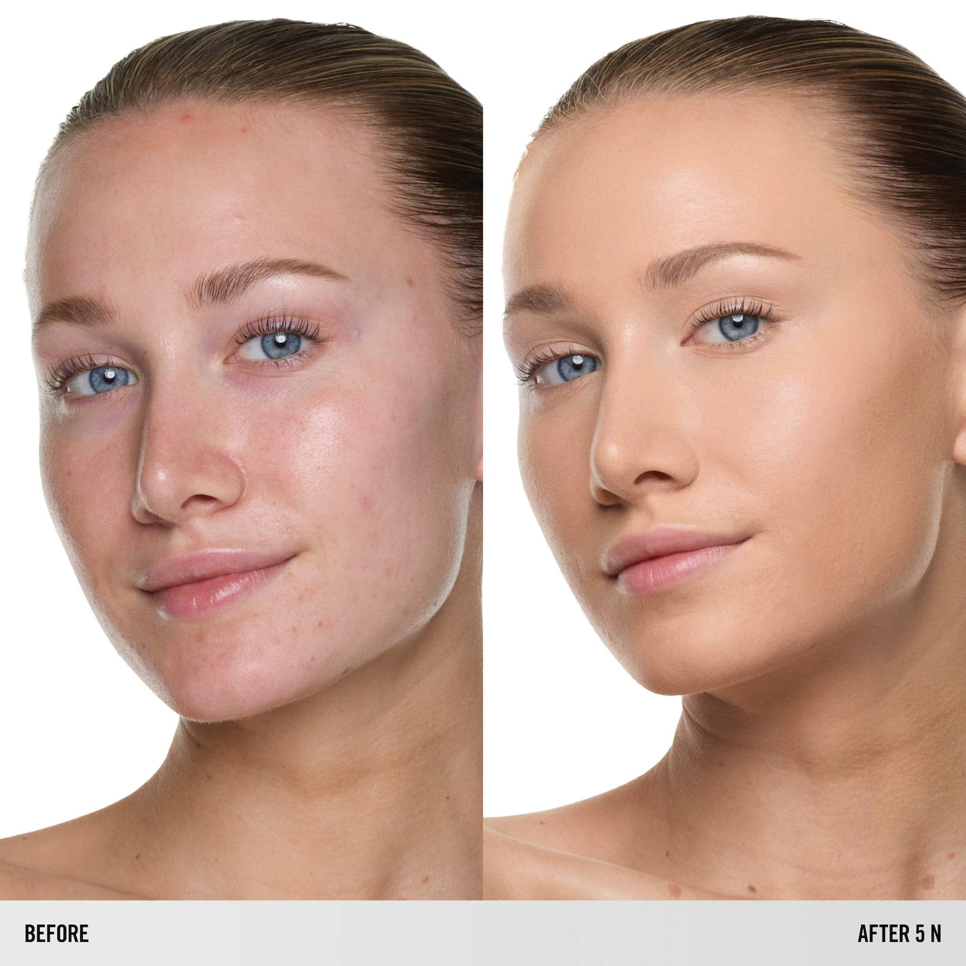 5 N - light with neutral undertone