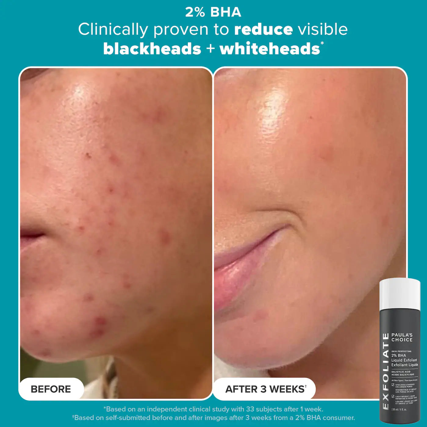 Pre-orden: Paula's Choice | Smooth & Glow Gift Set for clearer, brighter skin - Imagen 3