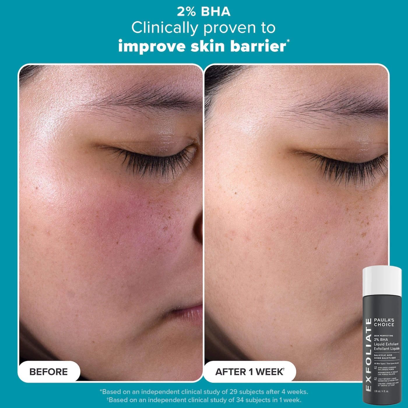 Pre-orden: Paula's Choice | Smooth & Glow Gift Set for clearer, brighter skin - Imagen 4